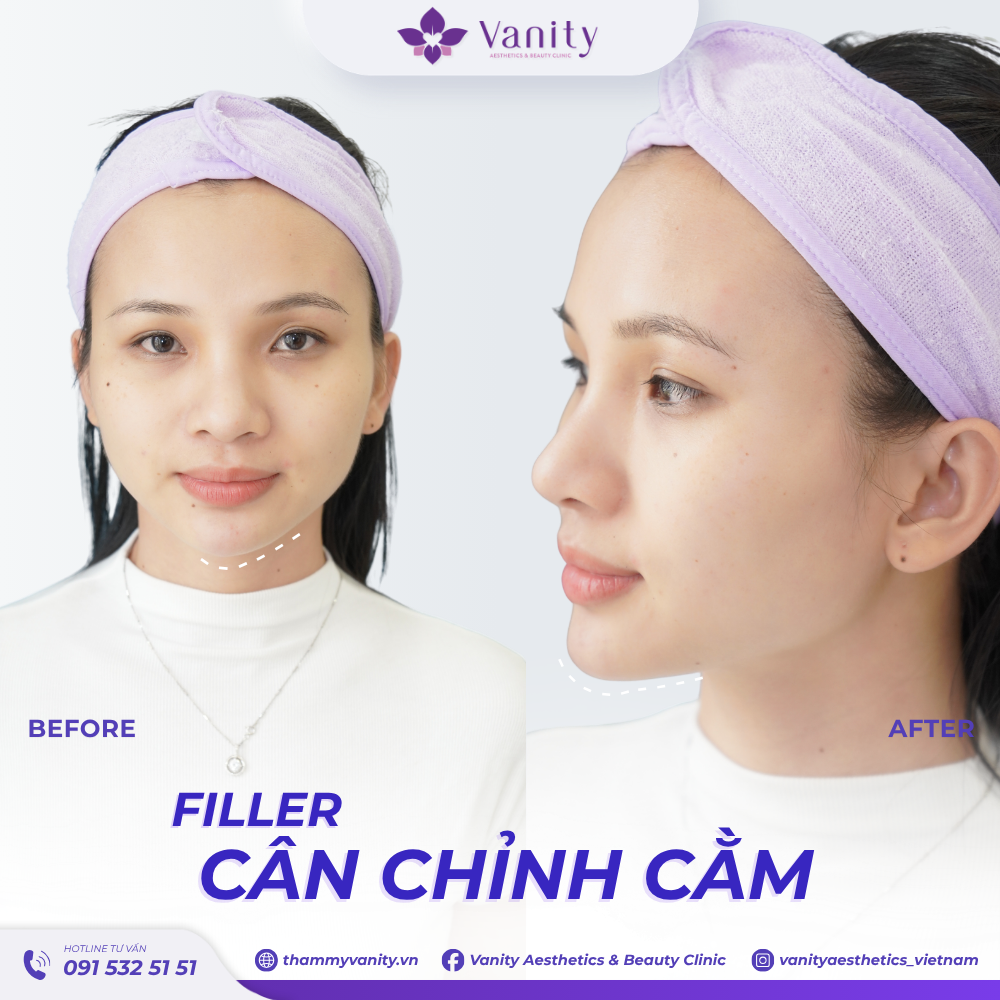 FILLER CÂN CHỈNH CẰM