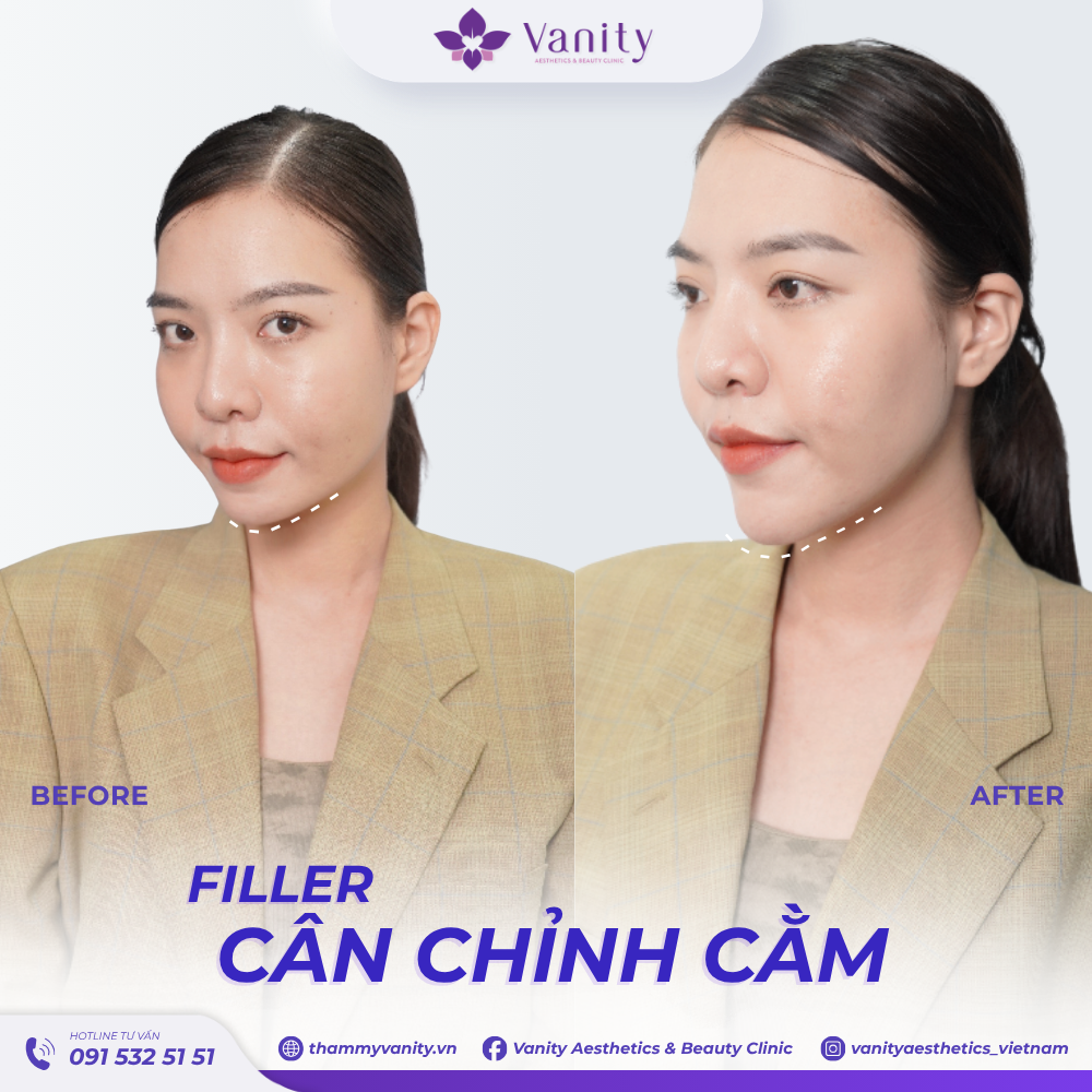FILLER CÂN CHỈNH CẰM
