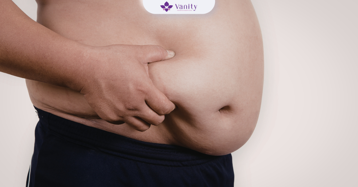 gai-den-o-nguoi-thua-can-beo-phi-dau-hieu-benh-ly-da-canh-bao-tinh-trang-roi-loan-chuyen-hoa