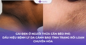 gai-den-o-nguoi-thua-can-beo-phi-dau-hieu-benh-ly-da-canh-bao-tinh-trang-roi-loan-chuyen-hoa