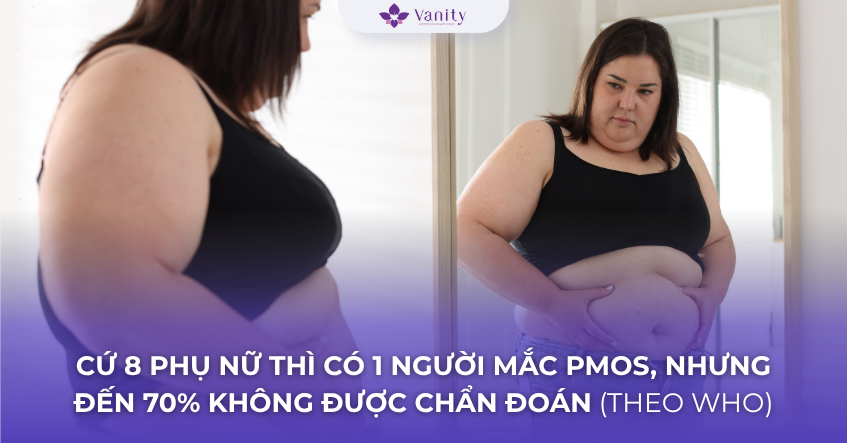 sau-91-nam-hoi-chung-buong-trung-da-nang-pcos-chinh-thuc-duoc-doi-ten
