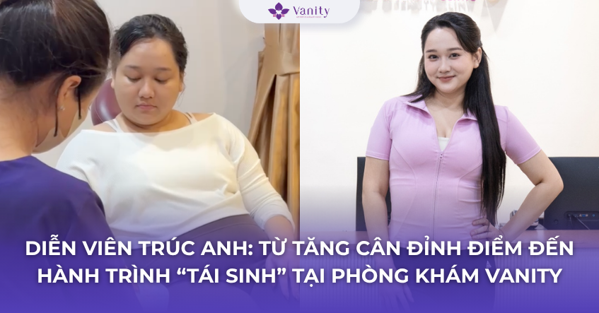truc-anh-giam-can