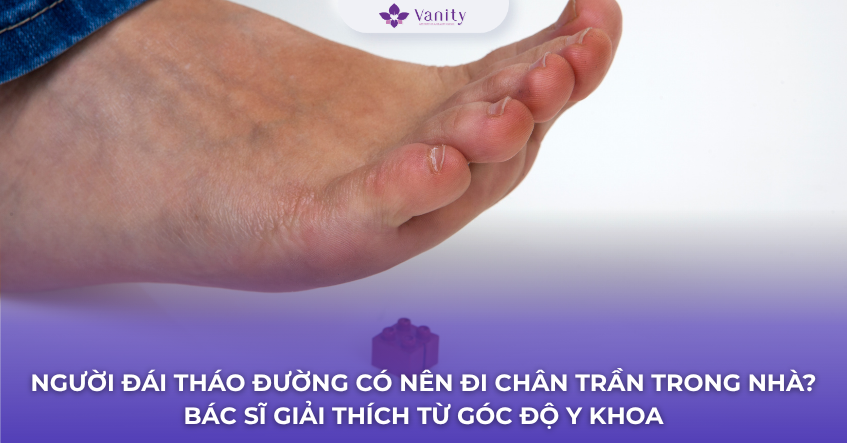 nguoi-dai-thao-duong-co-nen-di-chan-tran-trong-nha-khong